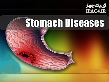 stomach-diseases-gh0267